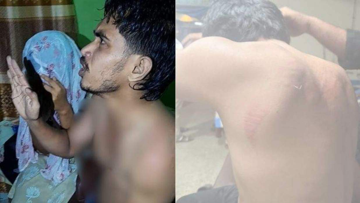 চবিতে নারী শিক্ষার্থীসহ ছাত্রদল নেতাকে আটক করে মারধর।